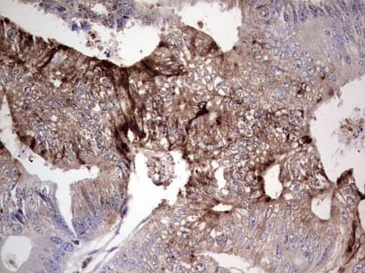 Monoclonal Mouse anti-Human PKM2 Antibody (clone 11B11, IHC, WB)