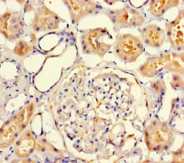 Polyclonal Rabbit anti-Human VMO1 Antibody