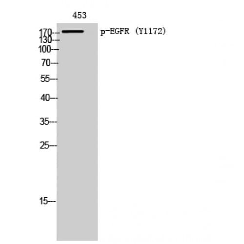 Polyclonal Rabbit anti-Human EGFR Antibody (1110-1190 aa, WB)