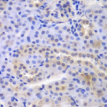 Polyclonal Rabbit anti-Human PSMA6 Antibody (IHC, IF, WB)