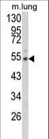 Fibulin-3 / EFEMP1 Antibody (aa119-148)