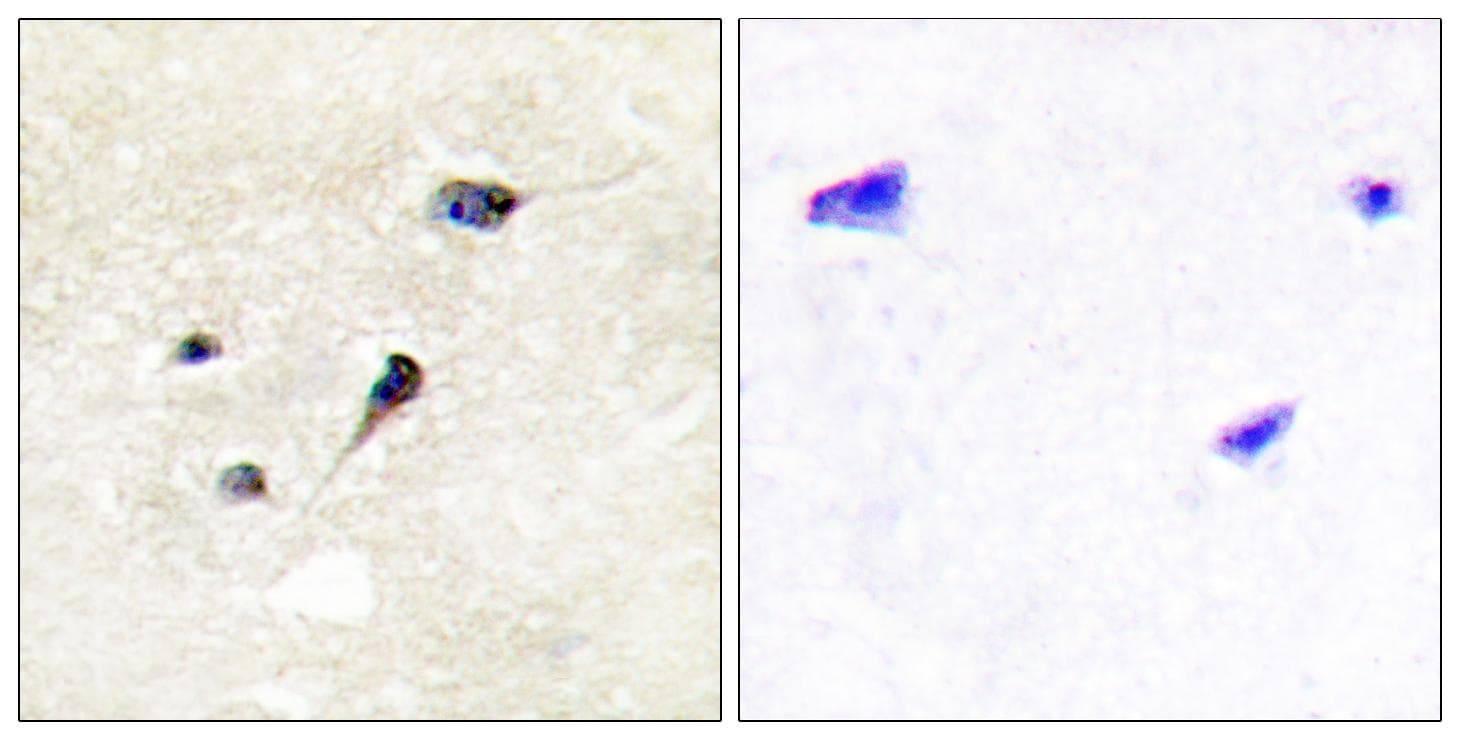 SYN1 / Synapsin 1 Antibody (phospho-Ser605)