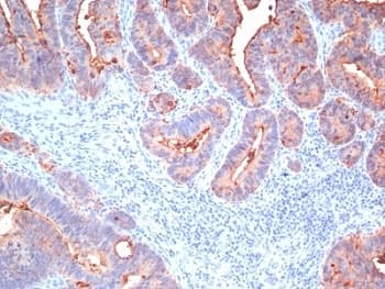 CEA / Carcinoembryonic Antigen Antibody (clone CEA-Cocktail)