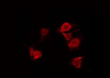 ERN1 / IRE1 Antibody