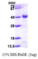 Human HAT1 Protein (Recombinant His)