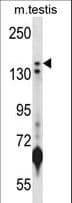 KDM5B / JARID1B Antibody (aa192-224)