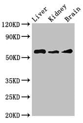 CHRM5 / M5 Antibody