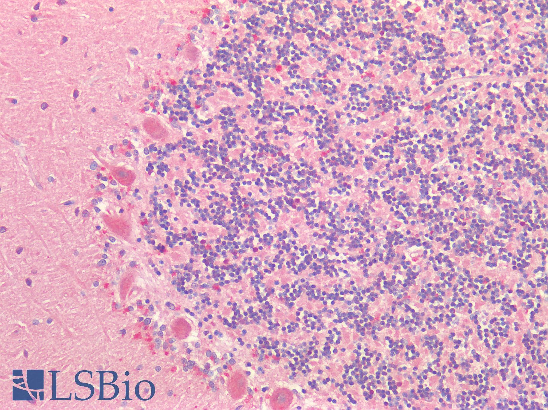 IHC-plus™ Polyclonal Rabbit anti-Human MAP2 Antibody (IHC)