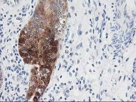 NUDEL / NDEL1 Antibody (clone OTI5E11)