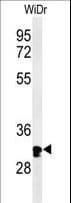 HCCS Antibody (aa173-200)