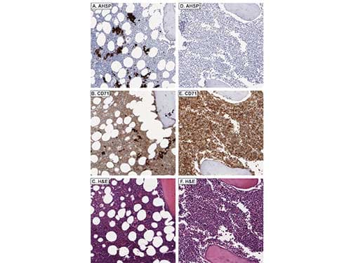 AHSP / EDRF Antibody (Liquid)