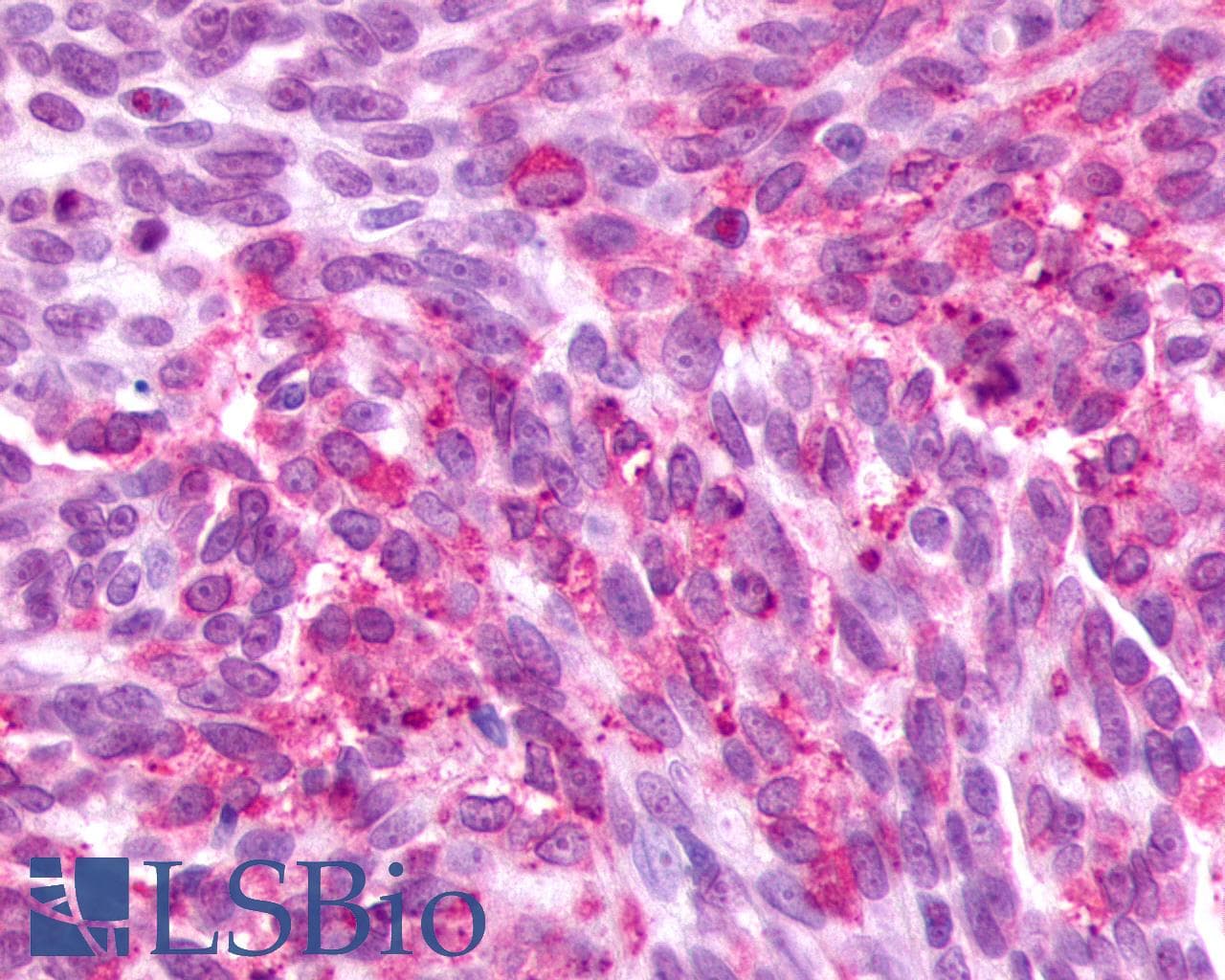 PathPlus™ F2RL3 / PAR4 Antibody (Cytoplasmic Domain)