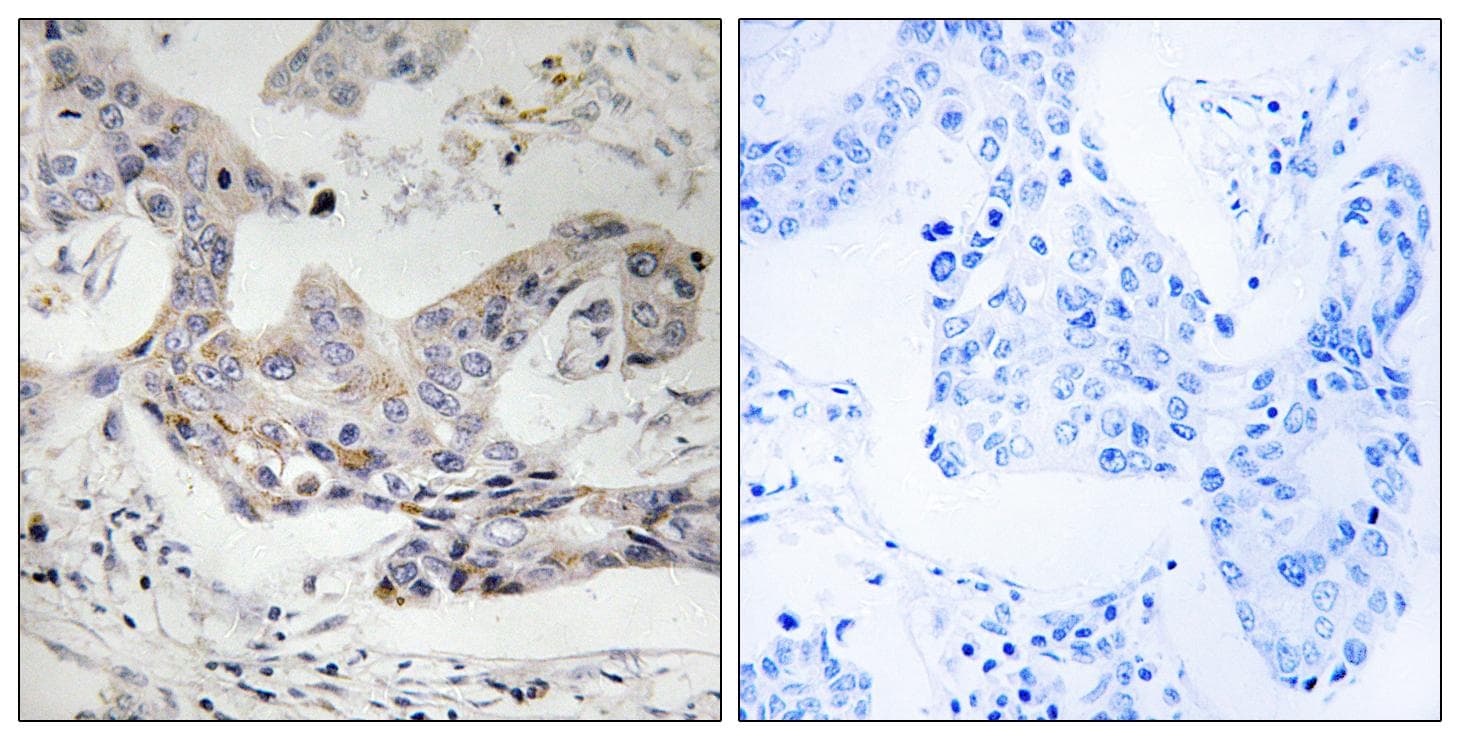 ALDH3B1 Antibody