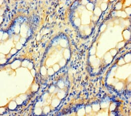 Polyclonal Rabbit anti-Human BCO1 / BCMO1 Antibody