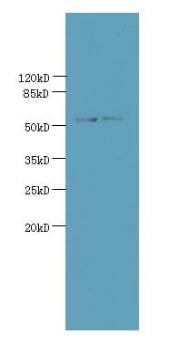 UTP15 Antibody