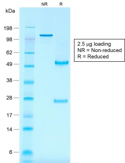 CD30 Antibody (clone rKi-1/779, Azide-free, Carrier-free)