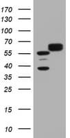 HSPD1 / HSP60 Antibody (clone OTI3G10)