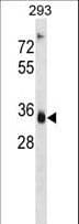 AKR1D1 Antibody (aa111-139)