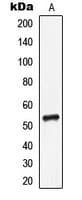 Polyclonal Rabbit anti-Human LILRA1 / LIR6 Antibody (Internal, WB)