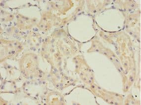ACOT9 Antibody