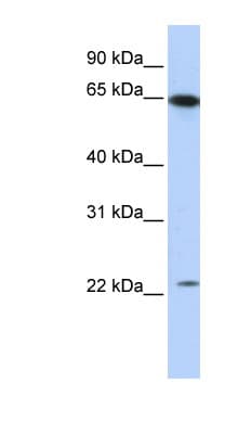 STAU1 / Staufen Antibody (N-Terminus)