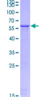 Human YWHAH / 14-3-3 Eta Protein (Recombinant GST)