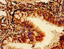 ROR2 Antibody