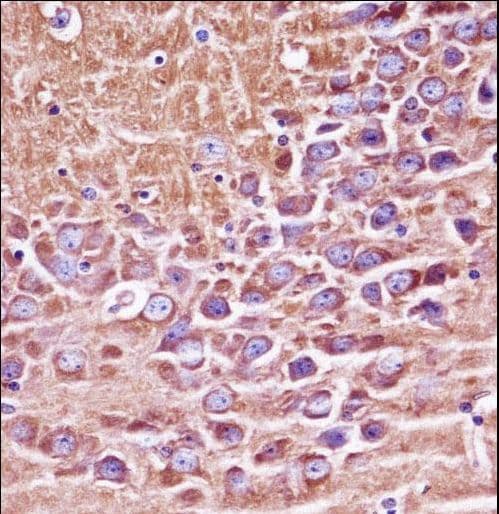 PRKACA + PRKACB Antibody (aa292-319)