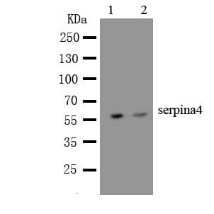 SERPINA4 / Kallistatin Antibody (aa384-401)