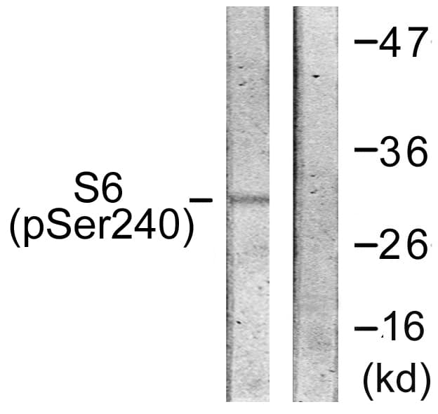 RPS6 / Ribosomal Protein S6 Antibody (phospho-Ser240)