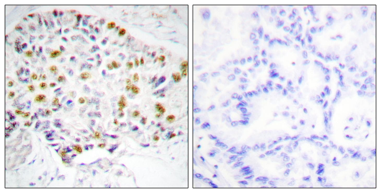 RB1 / Retinoblastoma / RB Antibody