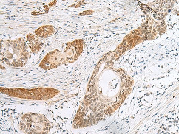 Polyclonal Rabbit anti-Human HIST1H2BN Antibody (IHC)