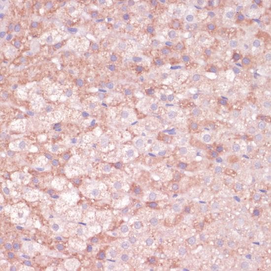 CYP11B2 / Aldosterone Synthase Antibody