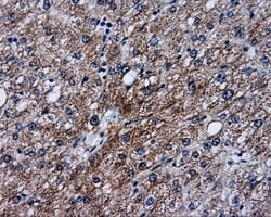 SRR / Serine Racemase Antibody (clone OTI1D7)