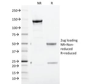 CD71 / Transferrin Receptor Antibody (clone TFRC/1817, Azide-free, BSA-free)