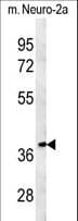 TNFAIP1 Antibody (aa288-316)