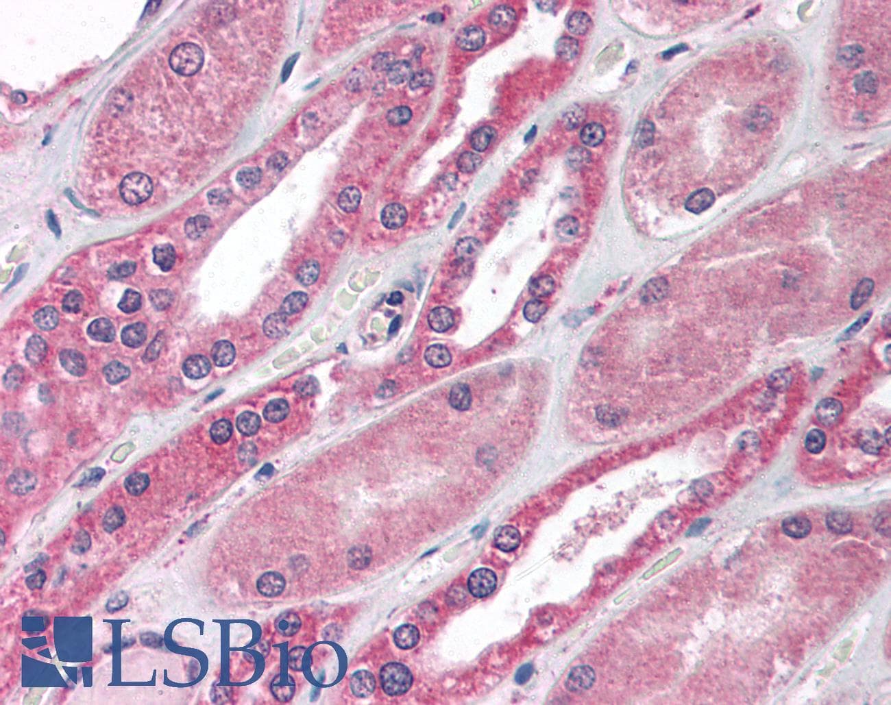 Polyclonal Rabbit anti-Human MBD1 Antibody (C-Terminus, IHC, WB)