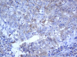 Selenium Binding Protein 1 Antibody (clone OTI3H1)