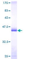 Human PTP4A1 / PRL-1 Protein (Recombinant GST)