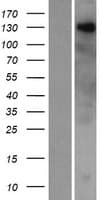 ZNF687 Protein (Over-Expression Lysate Myc-DDK (Flag))