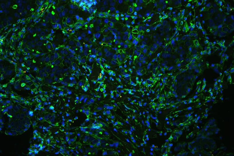 Polyclonal Rabbit anti-Human ANXA6/Annexin A6/Annexin VI Antibody (IHC, WB)