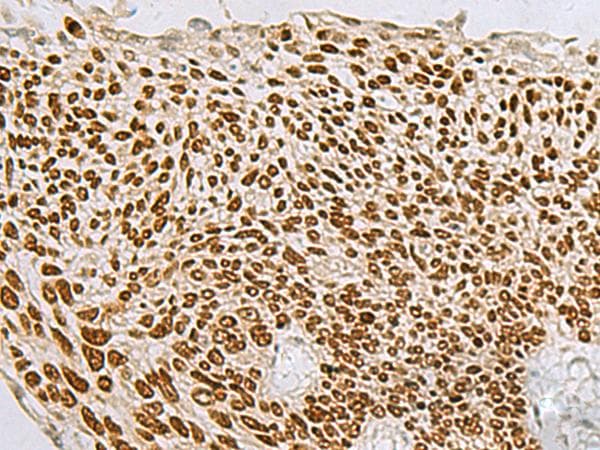 TP63 / p63 Antibody