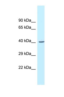 GCAT Antibody (aa219-268)