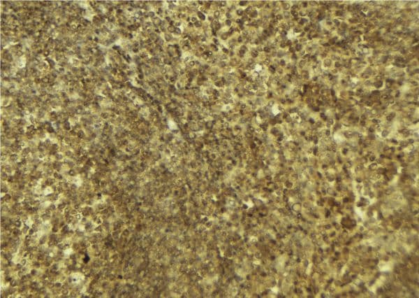 PARP4 / VPARP Antibody