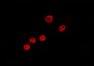 Polyclonal Rabbit anti-Human NLE1 Antibody (IF, WB)