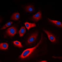 CALM1 / Calmodulin Antibody (phospho-Thr80/Ser82)