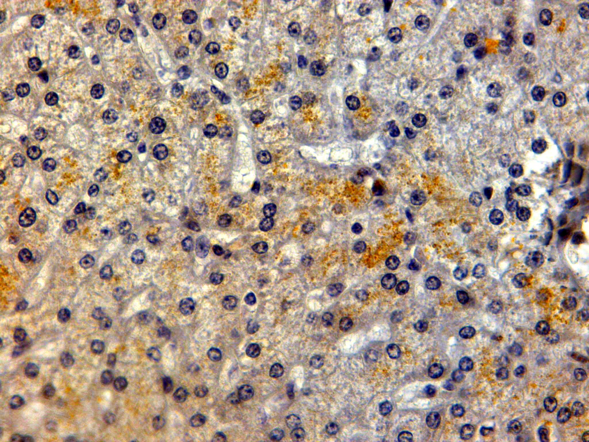 Polyclonal Goat anti-Human LRP5 Antibody (aa1178-1189, IHC, WB)