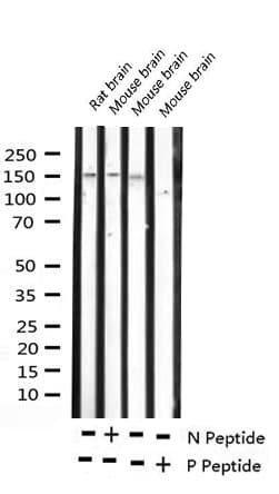MAP3K5 / ASK1 Antibody (phospho-Ser966)