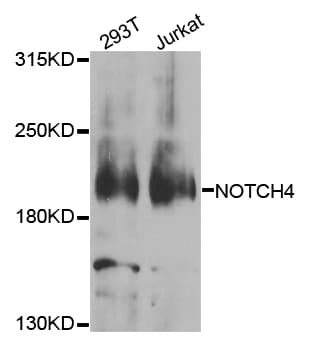 Polyclonal Rabbit anti-Human NOTCH4 Antibody (WB)