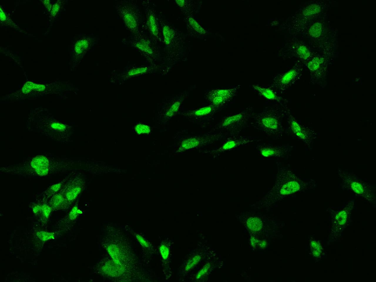 OGFOD1 Antibody